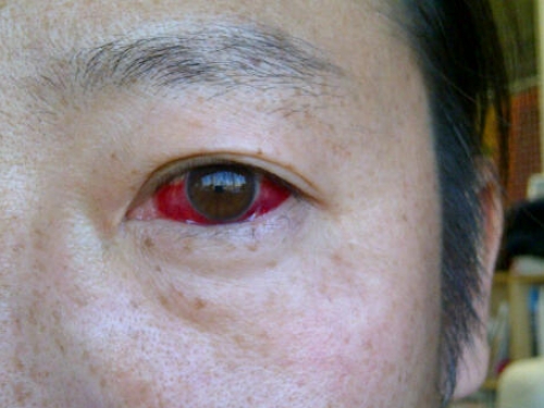 2013120604eye.jpg